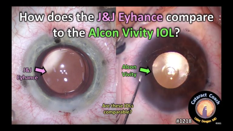 Which lens is better Alcon or Johnson and Johnson?