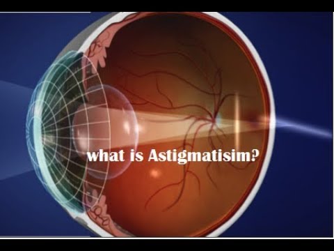 Why does squinting help astigmatism?