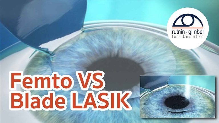 Revolutionize Your Vision with Bladeless LASIK: A Comprehensive Guide