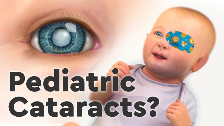 Defining and Treating Congenital Cataracts in Children: A Guide for Optical Care