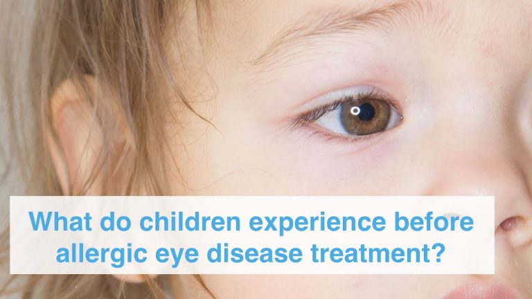 5 Tips to Manage Eye Allergies in Children with Optical and Vision Care Products
