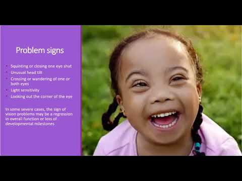 Ultimate guide to eye care for children with Down syndrome: Tips and products from optical professionals