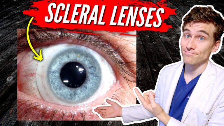 Discover the Advantages of Scleral Contact Lenses for Optimal Vision Care