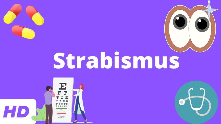 How to Correct Strabismus with Optical & Vision Care Products